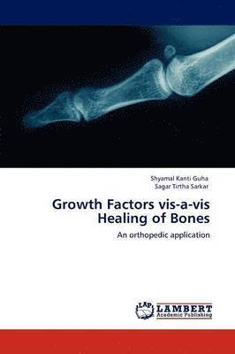 Growth Factors vis-a-vis Healing of Bones 1