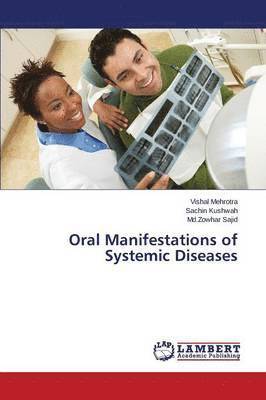 Mehrotra Vishal, Kushwah Sachin, Sajid MD Zowhar, Vishal Mehrotra, Sachin Kushwah, Md. Zowhar Sajid - Oral Manifestations of Systemic Diseases, Häftad
