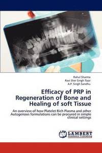 bokomslag Efficacy of Prp in Regeneration of Bone and Healing of Soft Tissue