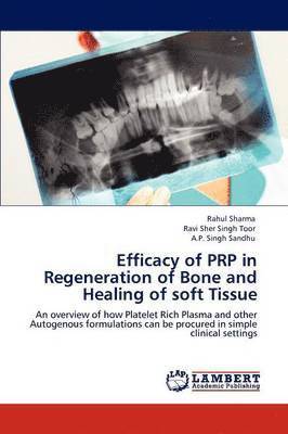 Rahul Sharma, Ravi Sher Singh Toor, A P Singh Sandhu - Efficacy of Prp in Regeneration of Bone and Healing of Soft Tissue, Häftad