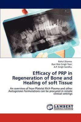 Efficacy of Prp in Regeneration of Bone and Healing of Soft Tissue 1