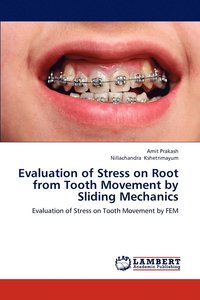 bokomslag Evaluation of Stress on Root from Tooth Movement by Sliding Mechanics