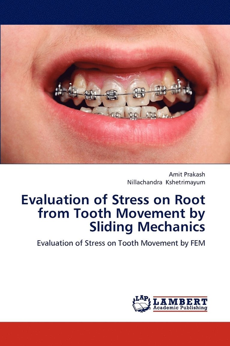 Evaluation of Stress on Root from Tooth Movement by Sliding Mechanics 1