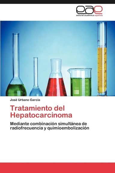 bokomslag Tratamiento del Hepatocarcinoma