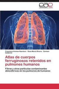 bokomslag Atlas de cuerpos ferruginosos retenidos en pulmones humanos