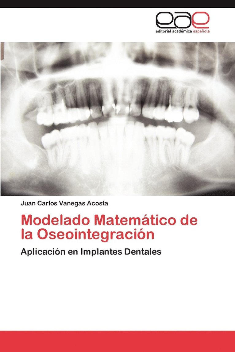 Modelado Matematico de La Oseointegracion 1