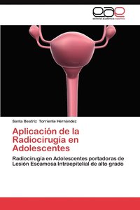 bokomslag Aplicacion de La Radiocirugia En Adolescentes