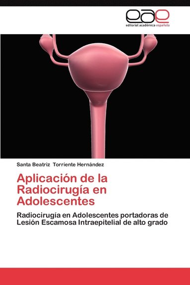 bokomslag Aplicacion de La Radiocirugia En Adolescentes