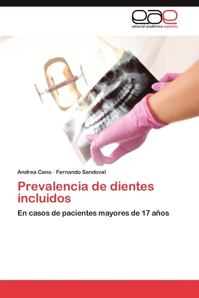 Prevalencia de Dientes Incluidos 1