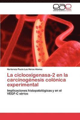 La Ciclooxigenasa-2 En La Carcinogenesis Colonica Experimental 1