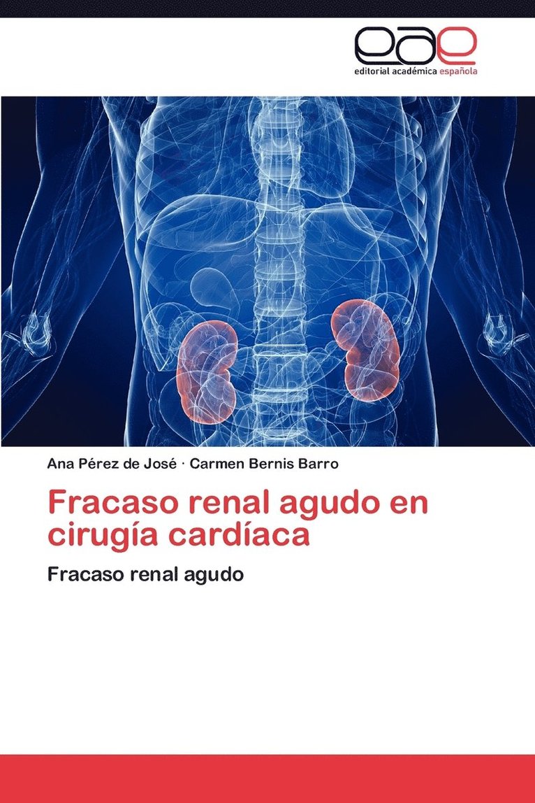 Fracaso Renal Agudo En Cirugia Cardiaca 1