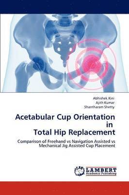 bokomslag Acetabular Cup Orientation in Total Hip Replacement