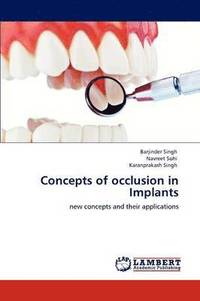 bokomslag Concepts of occlusion in Implants