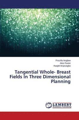 Tangential Whole- Breast Fields in Three Dimensional Planning 1