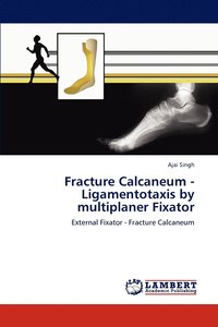 bokomslag Fracture Calcaneum - Ligamentotaxis by multiplaner Fixator