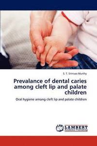 bokomslag Prevalance of dental caries among cleft lip and palate children