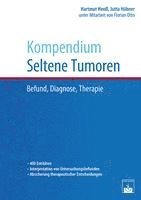 Kompendium Seltene Tumoren 1