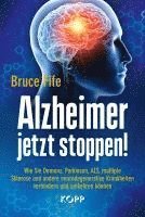 bokomslag Alzheimer jetzt stoppen!