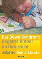 bokomslag Das Down-Sydrom - Begabte Kinder im Unterricht