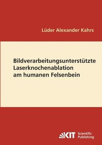 bokomslag Bildverarbeitungsunterstützte Laserknochenablation am humanen Felsenbein