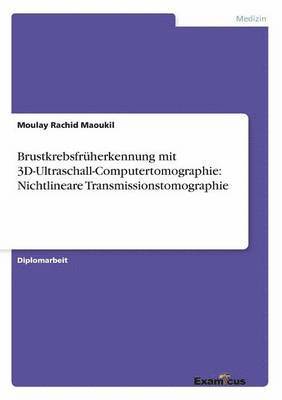 bokomslag Brustkrebsfruherkennung mit 3D-Ultraschall-Computertomographie