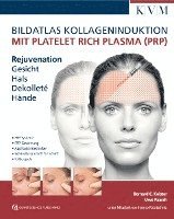 bokomslag Bildatlas Kollageninduktion mit Platelet Rich Plasma (PRP)