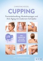 bokomslag Cupping