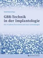 Daniel Buser - GBR-Technik in der Implantologie, Inbunden. Tillgänglighet: Lägg i varukorg