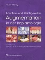 bokomslag Knochen- und Weichgewebeaugmentation in der Implantologie