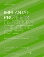bokomslag Implantatprothetik