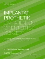 bokomslag Implantatprothetik