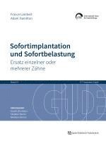 bokomslag Sofortimplantation und Sofortbelastung