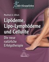 Lipoödeme, Lipo-Lymphödeme und Cellulite 1