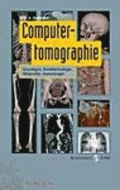 Willi A. Kalender - Computertomographie: Grundlagen, Gerätetechnologie, Bildqualität, Anwendung, Inbunden