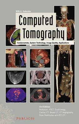 bokomslag Computed Tomography