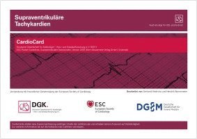 Supraventrikuläre Tachykardien, Häftad. Tillgänglighet: Lägg i varukorg