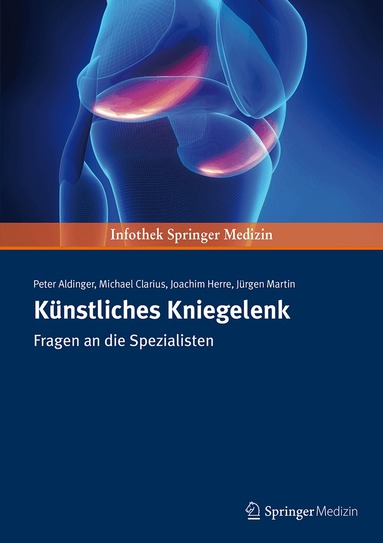Peter Aldinger, Joachim Herre, Michael Clarius, Martin Juergen - Künstliches Kniegelenk, Häftad