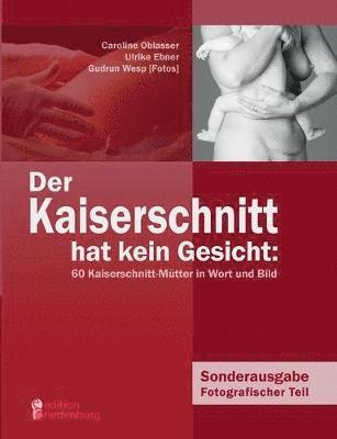 Kaiserschnitt hat kein Gesicht