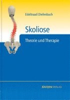 Skoliose 1