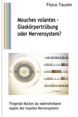 bokomslag Mouches volantes - Glaskörpertrübung oder Nervensystem?