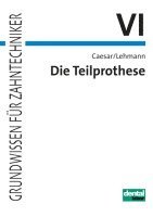 Hans H. Caesar, Klaus M. Lehmann - Die Teilprothese, Häftad