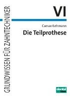 Die Teilprothese 1