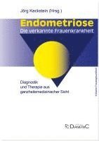 bokomslag Endometriose - Die verkannte Frauenkrankheit