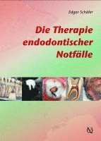 bokomslag Die Therapie endodontischer Notfälle