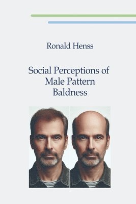 bokomslag Social Perceptions of Male Pattern Baldness