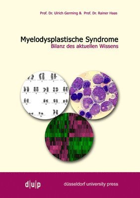 bokomslag Myelodysplastiche Syndrome: Bilanz Des Aktuellen Wissens