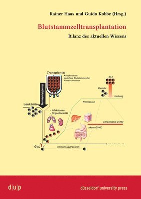 bokomslag Blutstammzelltransplantation