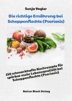 Sonja Vogler - Die richtige Ernährung bei Schuppenflechte (Psoriasis), Häftad