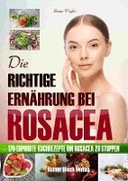Sonja Vogler - Die richtige Ernährung bei Rosacea, Häftad