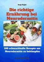 Sonja Vogler - Die richtige Ernährung bei Neurodermitis, Häftad